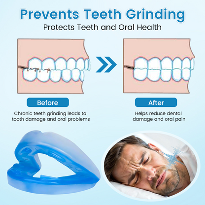 LAST DAY SALE 60% OFF⏰PerfectSleep Solution- Snore-Reducing & Teeth-Grinding Guard