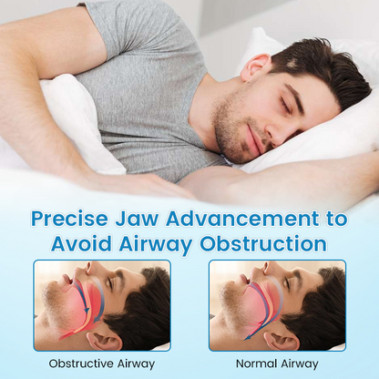 LAST DAY SALE 60% OFF⏰PerfectSleep Solution- Snore-Reducing & Teeth-Grinding Guard